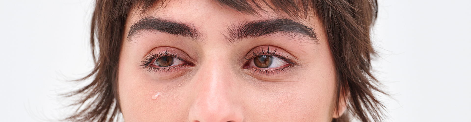 Watery Eyes: Causes, Treatment, and More