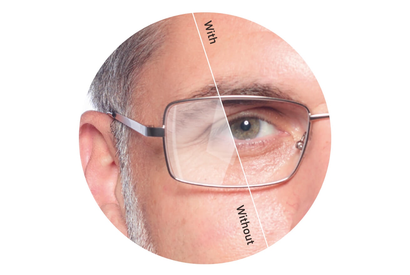 Lens enhancements, Lens add-ons, Glasses
